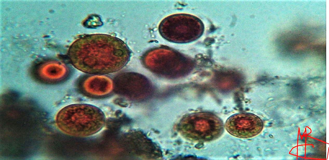 Haematococcus pluvialis